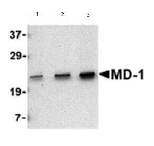 Lane 1 :  Anti-MD1 antibody - Carboxyterminal end (ab62507) at 0.5 µg/mlLane 2 :  Anti-MD1 antibody - Carboxyterminal end (ab62507) at 1 µg/mlLane 3 :  Anti-MD1 antibody - Carboxyterminal end (ab62507) at 2 µg/mlLane 1 : Daudi cell lysateLane 2 : Daudi cell lysateLane 3 : Daudi cell lysateLysates/proteins at 15 µg per lane.