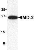 Anti-MD2 antibody (ab24182) at 1 µg/ml (mouse spleen lysate)
