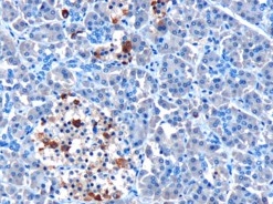 Ab4544 (10ug/ml) staining human MDA5 in human pancreas by immunohistochemistry using paraffin embedded tissue. Microwaved antigen retrieval with Tris/EDTA buffer pH9, HRP-staining. Ab4544 shows strong cytoplasmic staining of some cells in the islets of Langerhans.