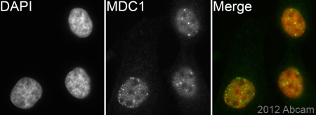 ab114143 (1/200) staining MDC1 in HeLa cells (green). Cells were fixed in paraformaldehyde, permeabilised in 0.5%Triton X100/PBS and counterstained with DAPI in order to highlight the nucleus (red). For further experimental details please refer to Abreview.See Abreview