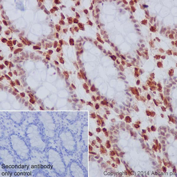 Immunohistochemical analysis of paraffin-embedded Human colon tissue labeling Histone H3.3 with ab176840 at 1/1000 dilution, followed by Goat Anti-Rabbit IgG H&L (HRP) (ab97051) secondary antibody at 1/500 dilution. Nucleus staining on Human colon tissue is observed. Counter stained with Hematoxylin.Secondary antibody only control: Used PBS instead of primary antibody, secondary antibody is Goat Anti-Rabbit IgG H&L (HRP) (ab97051) at 1/500 dilution.