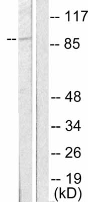 All lanes : Anti-MDM2 antibody (ab53710) at 1/500 dilutionLane 1 : Extracts from SKOV3 cells, minus immunising peptideLane 2 : Extracts from SKOV3 cells, plus immunising peptide