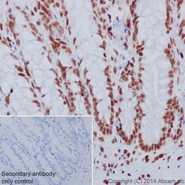 Immunohistochemical analysis of paraffin-embedded rat colon tissue labeling Histone H3.3 with ab176840 at 1/1000 dilution, followed by Goat Anti-Rabbit IgG H&L (HRP) (ab97051) secondary antibody at 1/500 dilution. Nucleus staining on Rat colon tissue is observed. Counter stained with Hematoxylin.Secondary antibody only control: Used PBS instead of primary antibody, secondary antibody is Goat Anti-Rabbit IgG H&L (HRP) (ab97051) at 1/500 dilution.