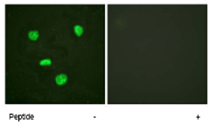 Immunofluorescence analysis of HeLa cells, using ab62642 at a 1/500 dilution. Left image untreated. Right image treated with peptide.