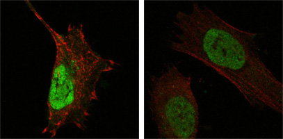 ab76362 at 1/2000 staining MDMX in human Hela (left) and L-02 (right) cells by Immunocytochemistry/ immunofluorescence. An Alexa Fluor® 488 conjugated Goat polyclonal to mouse IgG1 was used as secondary antibody. Green staining in image show positive staining with ab76362, whilst actin filaments were stained red with DY554 phalloidin.