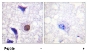Immunohistochemistry analysis of paraffin embedded human brain tissue using ab62642 at a 1/50 dilution. Left image untreated. Right image treated with peptide.