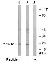 All lanes : Anti-MED18 antibody (ab74937) at 1/500 dilutionLane 1 : extracts from Jurkat cells Lane 2 : extracts from COLO cellsLane 3 : extracts from COLO cells with immunizing peptide at 10 µgLysates/proteins at 30 µg per lane.
