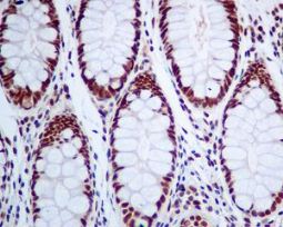 ab129170, at 1/100 dilution staining MED4 in paraffin-embedded Human colon tissue, by Immunohistochemistry.