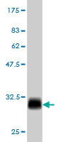 Western blot against tagged recombinant protein immunogen using ab57703 MED8 antibody at 1ug/ml.