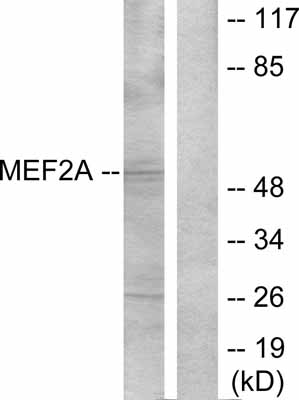 All lanes : Anti-MEF2A antibody (ab30668)Lane 1 : Extracts from NIH/3T3 cells (5-30ug), treated with PMA.Lane 2 : The same extracts treated with the same antibody, but preincubated with synthesized peptide.Secondarygoat-anti-rabbit IgG-AP-conjugate.