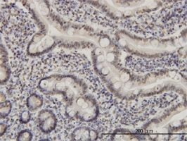 MEF2A antibody (ab55547) used in immunohistochemistry at 3ug/ml on formalin fixed and paraffin embedded human small Intestine.