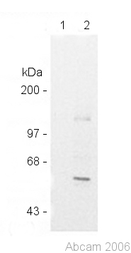 Immunoprecipitation of 35S-methionine labelled HeLa cells with anti-MEF2D sera. 1: pre-immune sera; 2: ab32845 anti-MEF2D sera. 