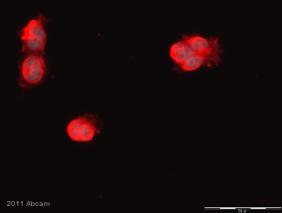 ab61251 staining Histone H3 in Rat choroid plexus cells by Immunocytochemistry/ Immunoflourescence. Cells were PFA-fixed and permeabilized in 0.1% Triton X-100 in PBS prior to blocking in 0.5% BSA in TBS-Tween for 20 minutes at room temperature. The primary antibody was diluted 1/50 in 0.5% BSA/PBS and incubated with the sample for 16 hours at 4°C. The secondary antibody was TRITC-conjugated Goat anti-Rabbit polyclonal, diluted 1/400. Nuclei were counterstained with Hoechst.See Abreview