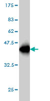Western blot against tagged recombinant protein immunogen using ab55576 MEFV antibody at 1ug/ml.