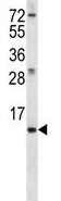 Anti-MEIG1 antibody (ab170652) at 1/100 dilution + K562 cell line lysate at 35 µgdeveloped using the ECL technique