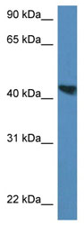 Anti-Meis homeobox 3 antibody (ab116003) at 1 µg/ml + Rat lung lysate at 10 µg