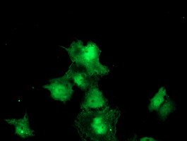 Immunofluorescent analysis of COS7 cells transiently transfected with pCMV6-ENTRY Meis homeobox 3 labelling Meis homeobox 3 with ab131640 at 1/100 dilution.