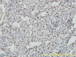 MEIS2 antibody (ab55647) used in immunohistochemistry at 1ug/ml on formalin fixed and paraffin embedded human spleen tissue.