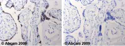 Ab39655 staining human normal placenta tissue. Staining is localised to nuclear compartment.Left panel: with primary antibody at 4 ug/ml. Right panel: isotype control.Sections were stained using an automated system DAKO Autostainer Plus , at room temperature. Sections were rehydrated and antigen retrieved with the Dako 3-in-1 AR buffer EDTA pH 9.0 in a DAKO PT Link. Slides were peroxidase blocked in 3% H2O2 in methanol for 10 minutes. They were then blocked with Dako Protein block for 10 minutes (containing casein 0.25% in PBS) then incubated with primary antibody for 20 minutes and detected with Dako Envision Flex amplification kit for 30 minutes. Colorimetric detection was completed with diaminobenzidine for 5 minutes. Slides were counterstained with Haematoxylin and coverslipped under DePeX. Please note that for manual staining we recommend to optimize the primary antibody concentration and incubation time (overnight incubation), and amplification may be required.