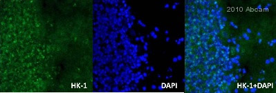 ab65069 staining Hexokinase 1 (green) in Rat brain tissue sections by Immunohistochemistry (IHC-Fr - frozen sections). Tissue was fixed with formaldehyde, permeabilized with 0.1% Triton X-100 and blocked with 5% BSA for 2 hours at 25°C. Samples were incubated with primary antibody (1/250 in PBS-T) for 2 hours at 25°C. An Alexa Fluor®488-conjugated Goat anti-rabbit IgG polyclonal (1/500) was used as the secondary antibody. Nuclei were stained by DAPI (blue).See Abreview