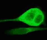 Immunofluorescent staining of HeLa cells using ab32517 at a dilution of 1/250.
