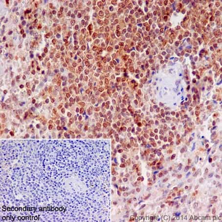 Immunohistochemical analysis of paraffin-embedded Human spleen tissue labeling MEK3 + MEK6 with ab200831 at 1/250 dilution followed by Goat Anti-Rabbit IgG H&L (HRP) (ab97051) at 1/500 dilution. Nuclear and cytoplasmic staining on Human spleen tissue is observed. Counter stained with Hematoxylin.Secondary antibody only control: Used PBS instead of primary antibody, secondary antibody is Goat Anti-Rabbit IgG H&L (HRP) (ab97051) at 1/500 dilution.