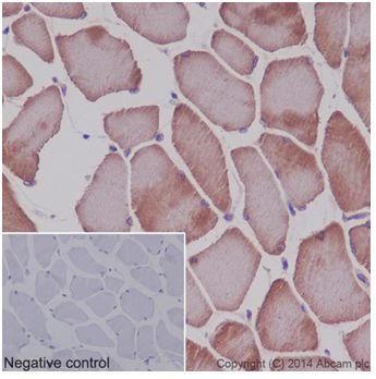 Immunohistochemical analysis of paraffin-embedded Mouse skeletal muscle tissue labeling MEK3 + MEK6 with ab181555 at 1/100 dilution followed by ab97051 Goat Anti-Rabbit IgG H&L (HRP) at 1/500 dilution. Cytoplasmic staining on Mouse skeletal muscle is observed. Counter stained with Hematoxylin.Negative control: Used PBS instead of primary ab.