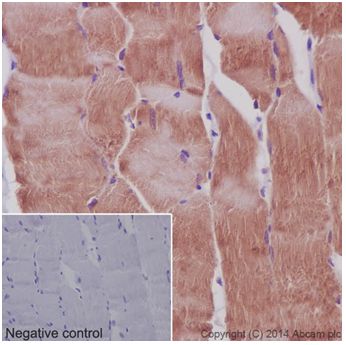 Immunohistochemical analysis of paraffin-embedded Rat skeletal muscle tissue labeling MEK3 + MEK6 with ab181555 at 1/100 dilution followed by ab97051 Goat Anti-Rabbit IgG H&L (HRP) at 1/500 dilution. Cytoplasmic staining on Rat skeletal muscle is observed. Counter stained with Hematoxylin.Negative control: Used PBS instead of primary ab.