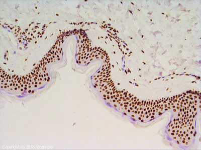 IHC image of Histone H3 staining in Human Skin formalin fixed paraffin embedded tissue section, performed on a Leica Bond system using the standard protocol F. The section was pre-treated using heat mediated antigen retrieval with sodium citrate buffer (pH6, epitope retrieval solution 1) for 20 mins. The section was then incubated with ab62706, 1µg/ml, for 15 mins at room temperature and detected using an HRP conjugated compact polymer system. DAB was used as the chromogen. The section was then counterstained with haematoxylin and mounted with DPX.