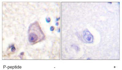 ab61112, at a 1/50 dilution, staining MEK4 in paraffin embedded human brain tissue by Immunohistochemistry with (+) or without (-) the immunising phospopeptide.