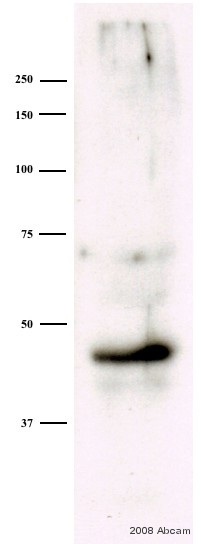 Anti-MEK4 (phospho S80) antibody (ab39403) at 1/1000 dilution + Whole cell lysates prepared from mouse small intestine epithelial cells at 30 µgSecondaryHRP conjugated goat polyclonal to rabbit IgG at 1/2500 dilutiondeveloped using the ECL techniquePerformed under reducing conditions.