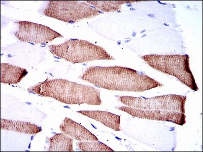 Immunohistochemical analysis of paraffin-embedded Human muscle tissues using ab119934 at a dilution of 1/200 with DAB staining.
