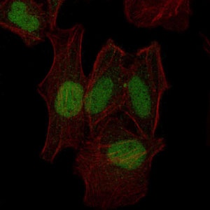 Immunofluorescence analysis of Hela cells using ab119934 at a dilution of 1/200 (green). Red: Actin filaments have been labeled with Alexa Fluor-555 phalloidin.