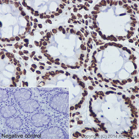 Immunohistochemical analysis of paraffin-embedded Human colon tissue labeling Histone H3 with ab176842 at 1/500 dilution, followed by Goat Anti-Rabbit HRP (IgG; H&L) secondary antibody (ab97051) at 1/500 dilution. Nucleus staining on glandular epithelium of Human colon tissue is observed. Counter stained with Hematoxylin.Negative control: Used PBS instead of primary antibody, secondary antibody Goat Anti-Rabbit IgG H&L (HRP) (ab97051) at 1/500 dilution.