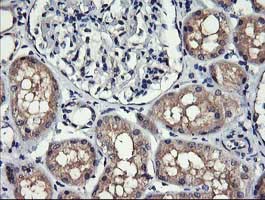 Immunohistochemical analysis of paraffin-embedded Human kidney tissue labelling MelanA with ab140503 at 1/150 dilution.