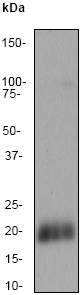 Anti-MelanA antibody [EP1422Y] (ab51061) at 1/1000 dilution + Melanoma lysate at 10 µgSecondaryGoat anti-Rabbit HRP labeled at 1/2000 dilution