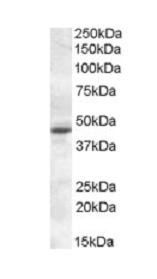 Anti-Melatonin Receptor 1A antibody (ab87639) at 0.3 µg/ml + KELLY lysate (in RIPA buffer) at 35 µgdeveloped using the ECL technique