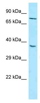 Anti-Melatonin Receptor 1B antibody (ab128469) at 1 µg/ml + HepG2 cell lysate at 10 µg