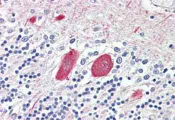 Immunohistochemical analysis of Formalin-fixed, Paraffin-embedded Human Brain Cerebellum tissue labelling Melatonin Receptor 1B with ab134824 at 3.75 µg/ml.