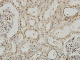 MEOX 2 antibody (ab55731) used in immunohistochemistry at 1ug/ml on formalin fixed and paraffin embedded human kidney.