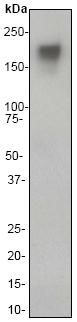 Anti-MERTK antibody [Y323] (ab52968) at 1/1000 dilution (unpurified) + HEK293 cell lysate at 10 µgSecondaryHRP-conjugated goat anti-rabbit IgG at 1/2000 dilutionObserved band size : 180 kDa (why is the actual band size different from the predicted?)