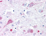 Human Brain, Thalamus (formalin-fixed, paraffin-embedded) stained with ab118447 at 4 µg/ml followed by biotinylated goat anti-rabbit IgG secondary antibody, alkaline phosphatase-streptavidin and chromogen.