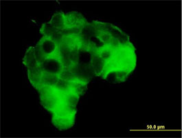 Immunofluorescent analysis of 293 cells labeling Metabotropic Glutamate Receptor 2 with ab169476 at 1 µg/ml.
