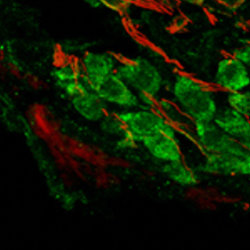 Immunohistochemical analysis of adult mouse cochlear ganglion labeling Metabotropic Glutamate Receptor 2 with ab167016 at 1/100 dilution (green). Neuron-specific class III beta-tubulin is stained red.