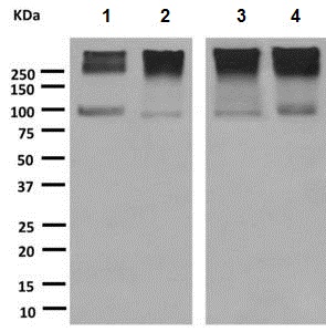 All lanes : Anti-Metabotropic Glutamate Receptor 2 antibody [EPR8975] (ab150387) at 1/10000 dilutionLane 1 : Human hypothalamus cell lysateLane 2 : Human fetal brain cell lysateLane 3 : Human cerebellum cell lysateLane 4 : Human fetal forebrain cell lysateLysates/proteins at 10 µg per lane.SecondaryHRP-labelled goat anti-rabbit antibody at 1/2000 dilution