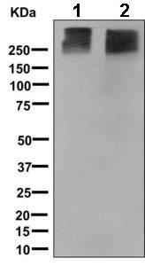 All lanes : Anti-Metabotropic Glutamate Receptor 3 antibody [EPR9009(2)] (ab166608) at 1/1000 dilutionLane 1 : Human cerebellum lysateLane 2 : Human hypothalamus lysateLysates/proteins at 10 µg per lane.SecondaryHRP labelled goat anti-rabbit at 1/2000 dilution