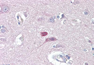 Immunohistochemical analysis of paraffin embedded Human brain, cortex tissue labelled with ab139397 at 10 µg/ml.
