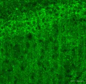 ab53090 staining Metabotropic Glutamate Receptor 5 in rat brain tissue sections by Immunohistochemistry (Free Floating).Animals were perfused fixed with 4% paraformaldehyde with 15% of a solution of saturated picric acid, in phosphate buffer 0.1M. Following postfixation in the same fixative overnight, the brains were cryoprotected in sucrose 30% overnight. Brains were then cut using a cryostat and the immunostainings were performed using ab53090 at a 1/300 dilution. The secondary used was an Alexa Fluor 488 conjugated goat anti-rabbit used at a 1/1000 dilution.ab53090 staining Metabotropic Glutamate Receptor 5 in rat brain tissue sections by Immunohistochemistry (Free Floating).Animals were perfused fixed with 4% paraformaldehyde with 15% of a solution of saturated picric acid, in phosphate buffer 0.1M. Following postfixation in the same fixative overnight, the brains were cryoprotected in sucrose 30% overnight. Brains were then cut using a cryostat and the immunostainings were perform