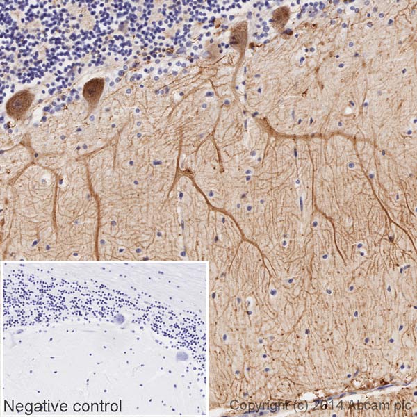 IHC image of Metabotropic Glutamate Receptor 5 staining in a section of formalin-fixed paraffin-embedded normal human cerebellum, performed on a Leica BOND. The section was pre-treated using heat mediated antigen retrieval with sodium citrate buffer (pH6, epitope retrieval solution 1) for 20mins. The section was then incubated with ab196482 at 1/100 dilution, for 15 mins at room temperature. DAB was used as the chromogen. The section was then counterstained with haematoxylin and mounted with DPX. The inset negative control image is taken from an identical assay without primary antibody.For other IHC staining systems (automated and non-automated) customers should optimize variable parameters such as antigen retrieval conditions, primary antibody concentration and antibody incubation times.