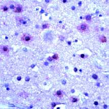 ab125261 at 1/50 dilution, for 10 minutes at RT, staining Metabotropic Glutamate Receptor 5b in Formalin-Fixed Human brain tissue by Immunohistochemistry.